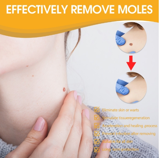 Cure warts spray