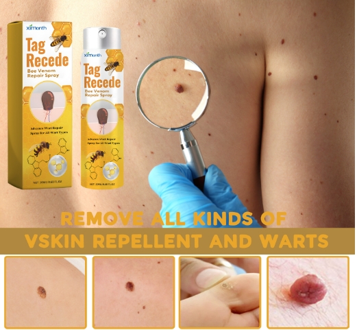 Cure warts spray