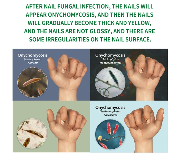 Whitenail Repair, Hand, Foot, Nail Care, Soft Nail Brightening and Moisturizing Liquid