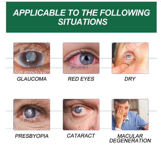 Eye Drops Eye Moisturizing Care Liquid Relieves Fatigue